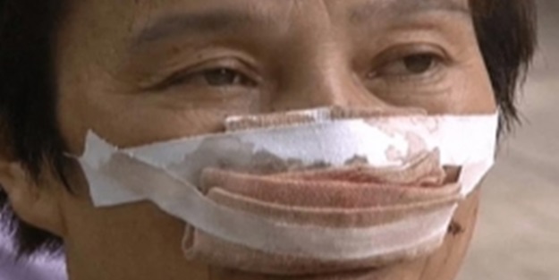 Karısının burnunu yuttu