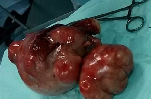 Karnından çıkanlar şok etti!