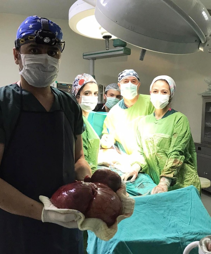 Karnından 5 kilo ağırlığında tümör çıkarıldı 