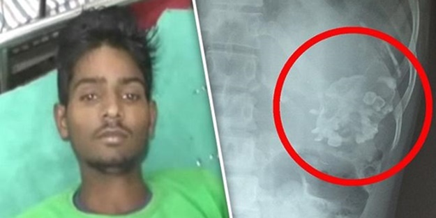 Karnından çıkana kimse inanamadı! - FOTO