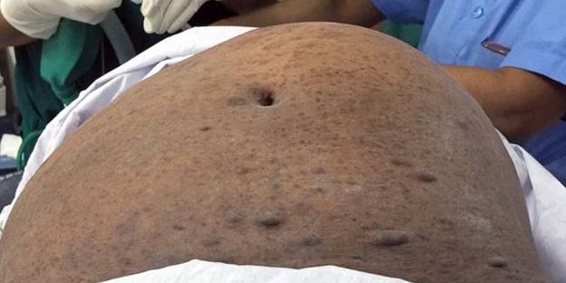 Karnından çıkanı gören doktorlar hayrete düştü!