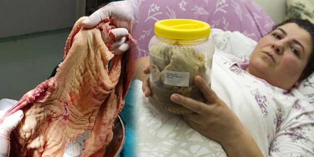 Karnından çıkanlar şoke etti! Tam 1.8 kilo