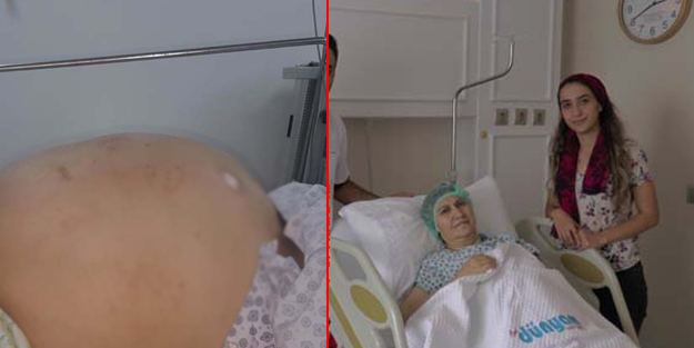 Karnından çıkanlara doktor bile hayret etti! Kayseri'de şaşırtan olay
