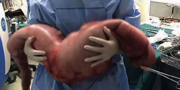 Karnından öyle bir şey çıktı ki!