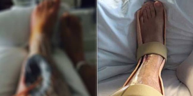 Kas yapayım derken vücudu pişti