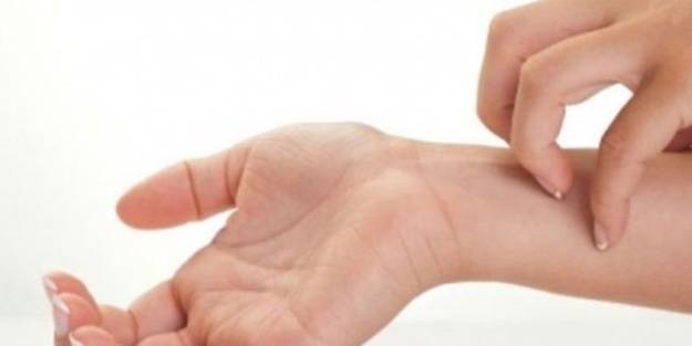 Kaşıntı deyip geçmeyin! Vücutta kaşıntı nedenleri nelerdir?