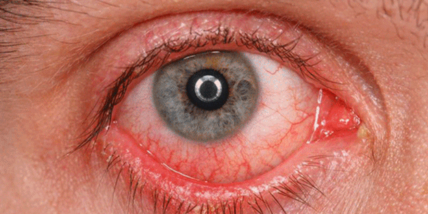 Mutlaka ciddiye alın! Çok tehlikeli...