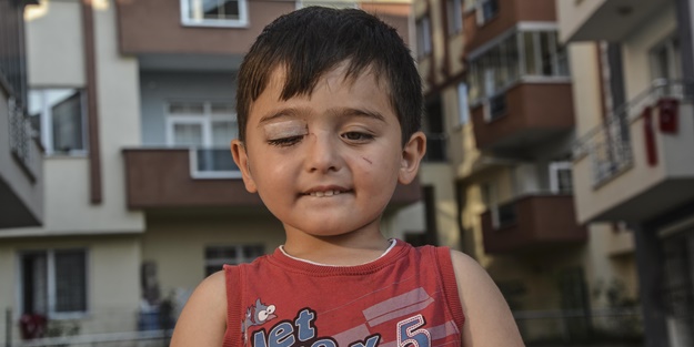 Kastamonu'da başıboş köpek dehşeti... Minik çocuk az kalsın canından oluyordu