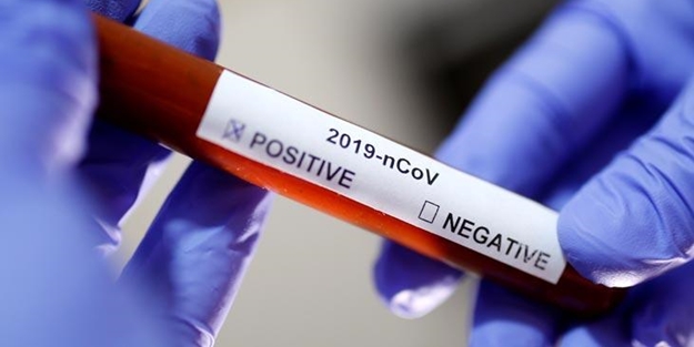 O ülkeden flaş koronavirüs kararı! Tamamen yasaklandı