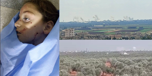 Katliam var: Savaş bitti denilen Suriye'de siviller ölmeye devam ediyor!