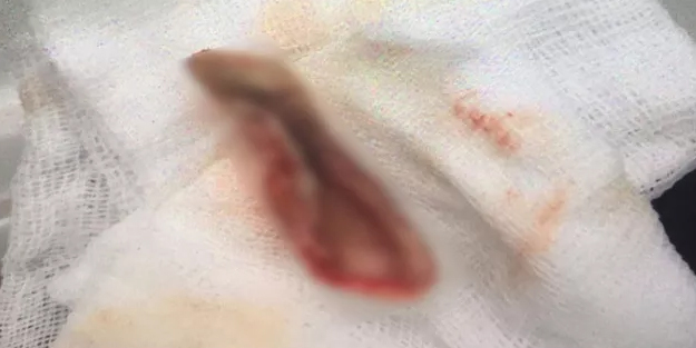 Kavga ettiği kişinin kulağını ısırarak koparttı! İlginç olay