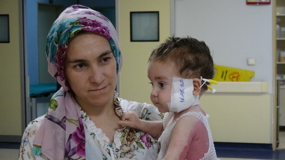 Kaynar süt kazanına düşen bebek yeniden hayata tutundu 