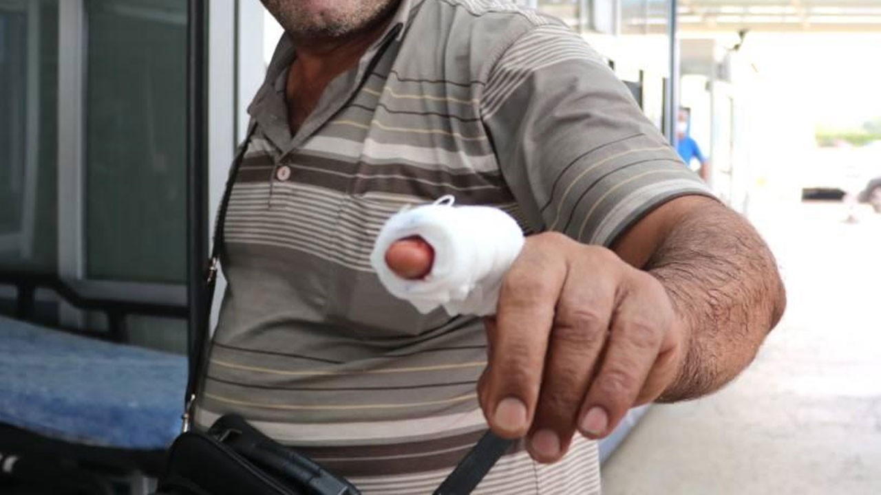 Kayseri’de acemi kasaplar acil servisleri doldurdu