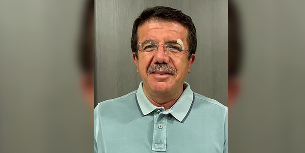Kaza yapan eski Bakan Zeybekci'den sağlık durumuna ilişkin mesaj