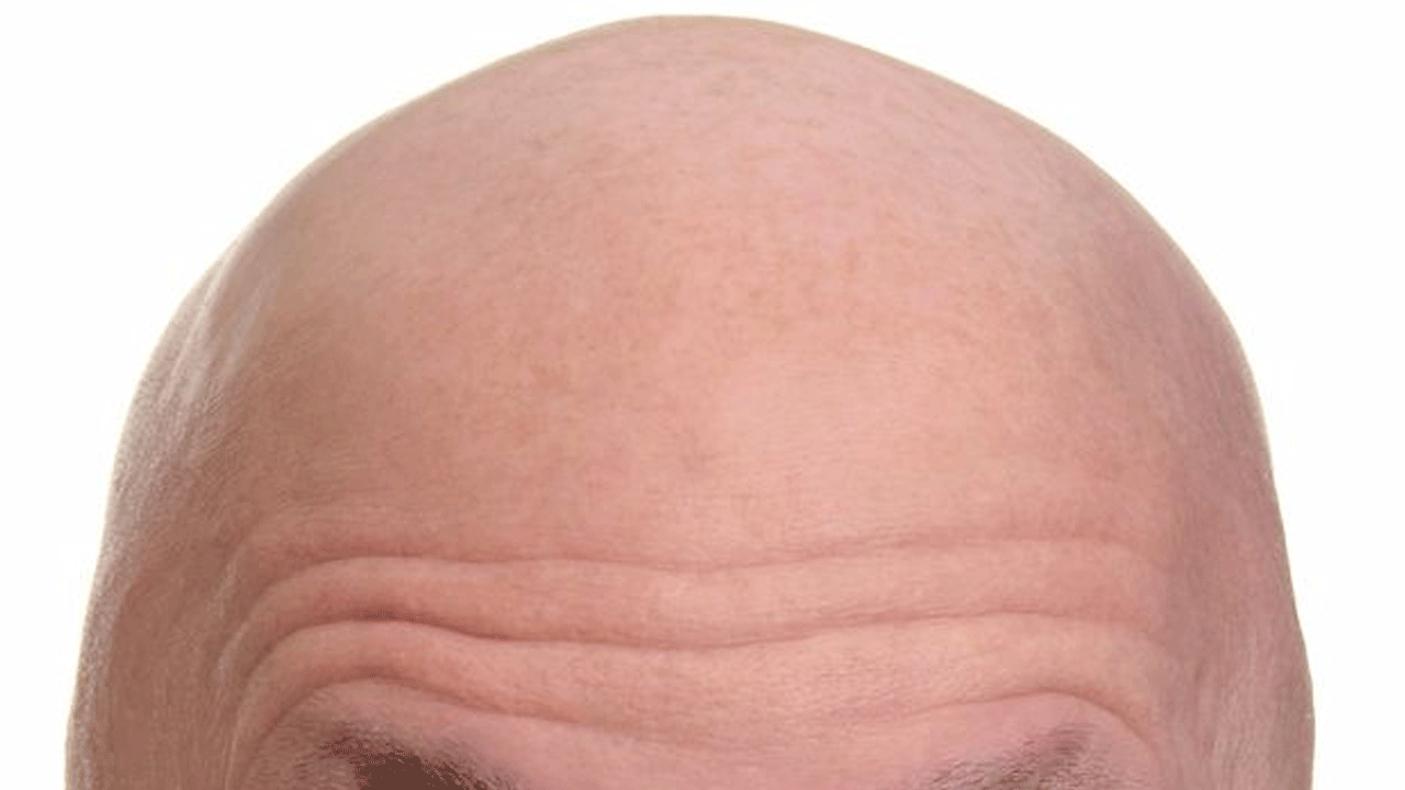 'Kel' demek cinsel taciz sayıldı