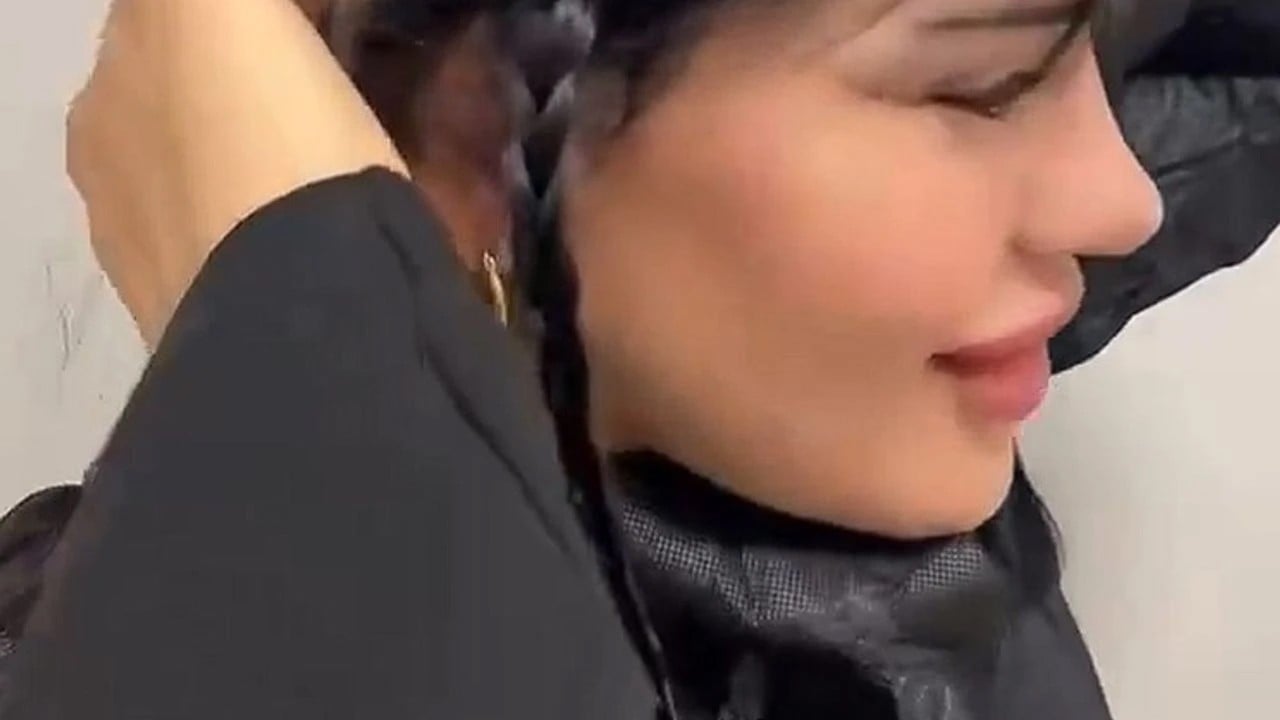  Kel oldu: Sosyal medya hesabından paylaştı! Estetik sonrası hali şoke etti!