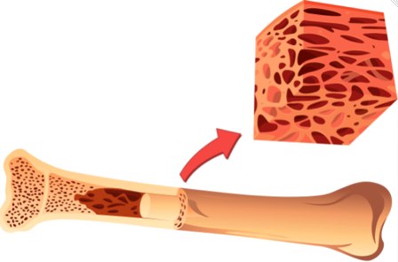 Kemik İliği Nakli Kimlere Yapılıyor?