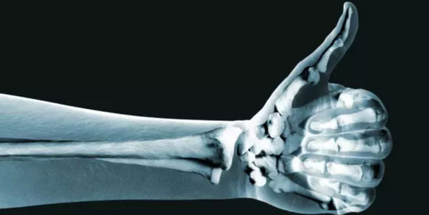 Kemik ve diş sağlığı için kalsiyum zengini en iyi 13 gıda