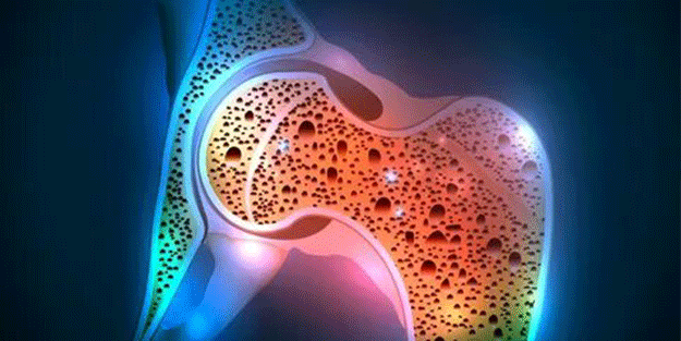 Kemikleri çelik gibi yapacak yöntem! Kemik erimesini önlemek için mutlaka bunları yapın