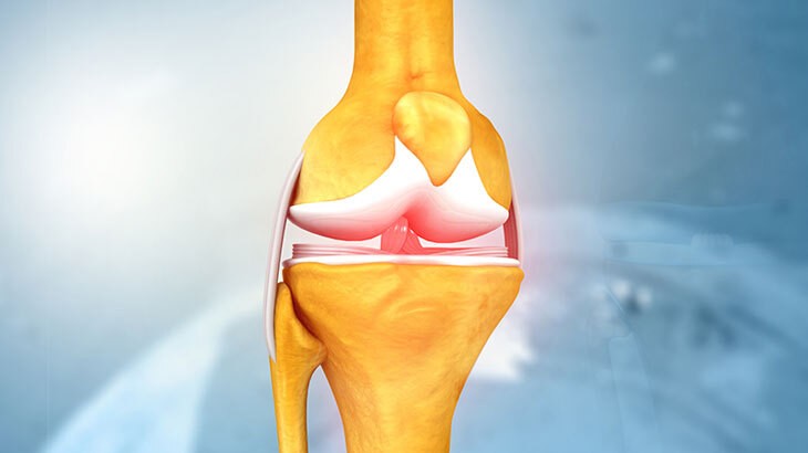 Kemiklerinizi ve eklemlerinizi bu tarifle güçlendirin: 20 yaşındaki biri gibi yavaş yavaş güç verir! İşte ev yapımı