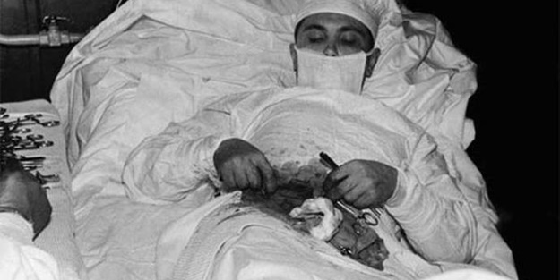 Kendi kendini ameliyat yapmıştı