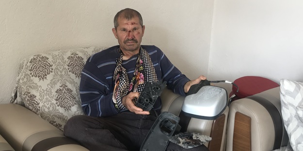 Kendisine çarpan aracın parçalarını delil olarak evine götürdü