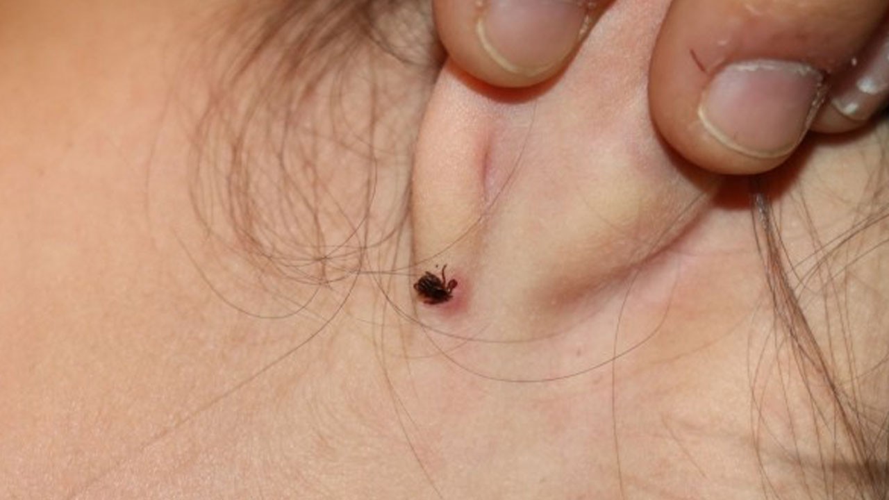 Kene tehlikesi yaz aylarında artıyor! Bu uyarıları kulağınıza küpe yapın