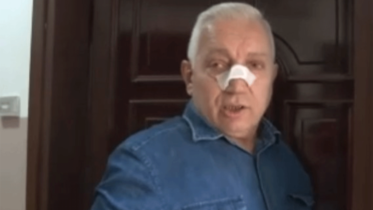 Kentsel dönüşüm istediği için darp edildi!