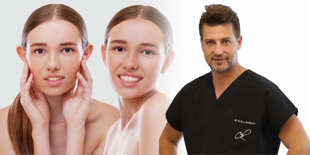 Kepçe kulak, artık dert değil 20 dakikada sorundan kurtulmak mümkün 