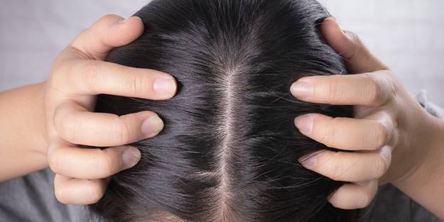 Kepek, saç dökülmesi, kaşıntı... Saç problemlerini ortadan kaldıracak 6 muhteşem bitki