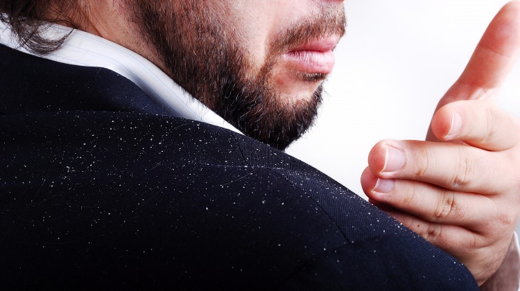 Kepek şampuanlarındaki tehlike!