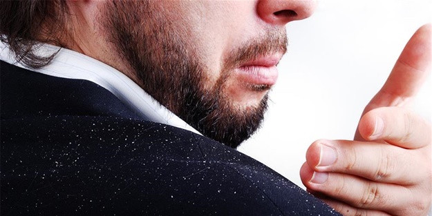 Kepekten kurtulmanın 11 doğal yolu