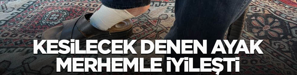 Kesilecek denen ayak merhemle iyileşti