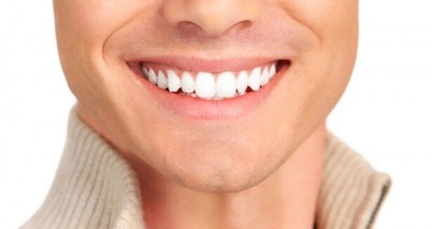 Kesinlikle hayal değil! Bembeyaz dişlerin sırrı bu haberde