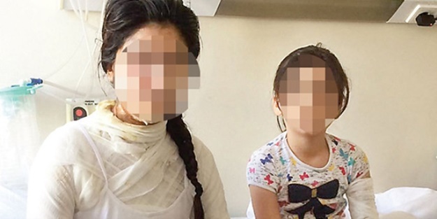 Kezzaplı saldırıya uğrayan kadın dehşeti anlattı