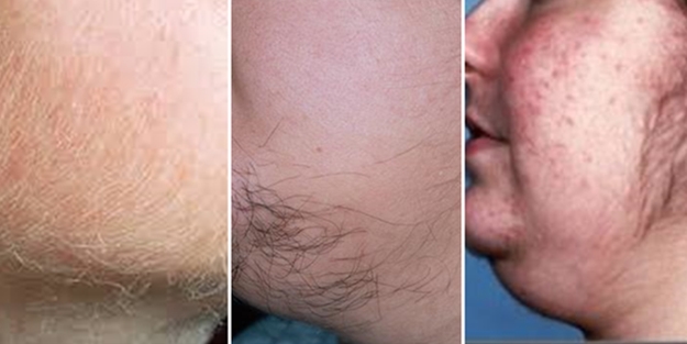 Hanımların büyük sorunu!