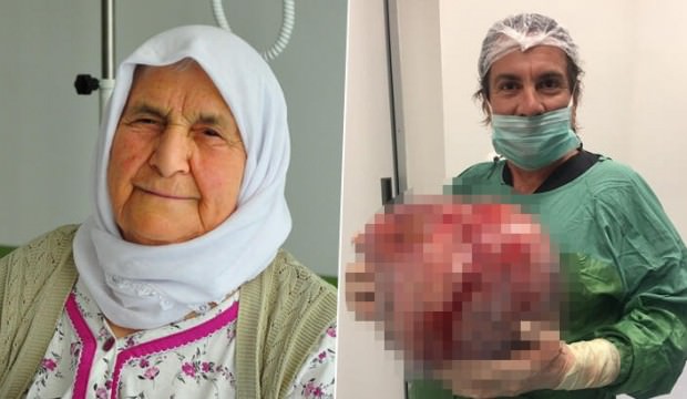 Kilo aldığını düşündü, karnından öyle bir şey çıktı ki!
