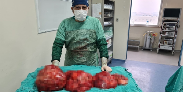 Kilo aldığını sanıyordu... Karnından çıkanlar şoke etti