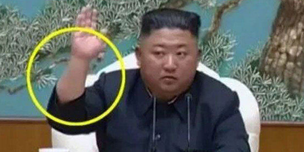 Kim Joung-un'un kolundaki detay bilgileri ortaya çıkardı! Yakın dostu her şeyi anlattı
