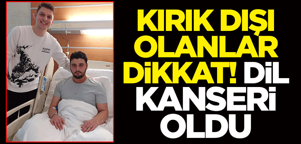 Kırık dişi olanlar dikkat! Ölümcül dil kanseri oldu