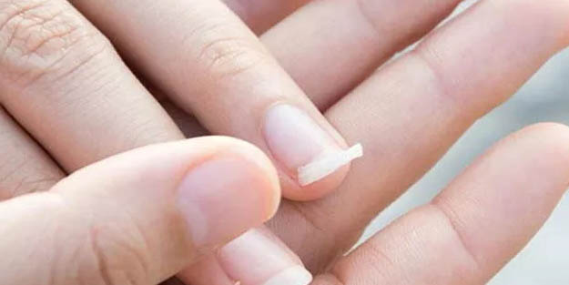 Kırılan tırnak nasıl onarılır? Kırılgan tırnakları güçlendiren doğal besinler
