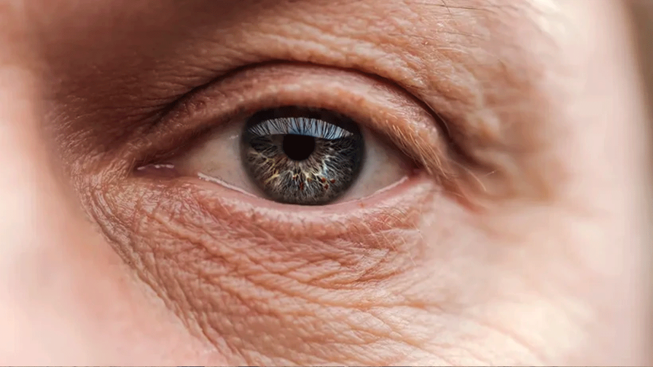 Kırışıklıklar yaşlılıktan değilmiş! Asıl neden sizi çok şaşırtacak