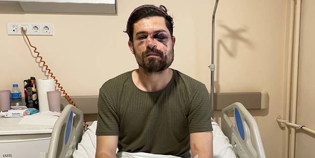 Kırmızı kart gören futbolcu, rakibini bu hale getirdi!