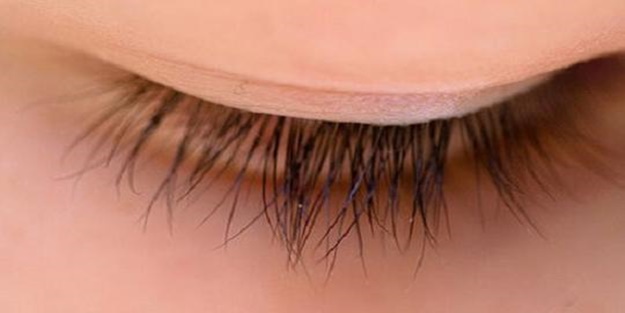 Kirpiğinizde sorun varsa...