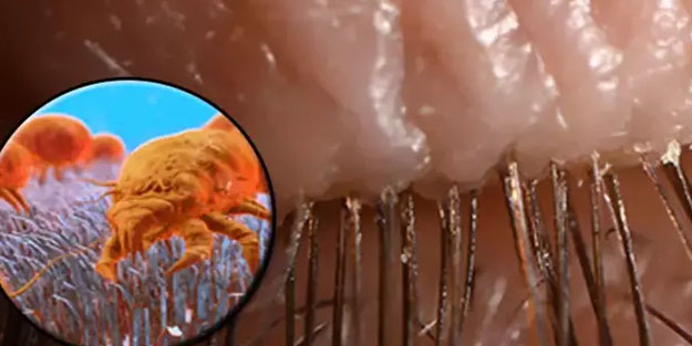 Kirpiklerimizde yaşayan binlerce böcek var: Çok şaşırttı!