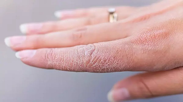 Kış aylarında şikayetler artıyor!