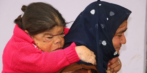 Kızını 36 senedir sırtında taşıyor