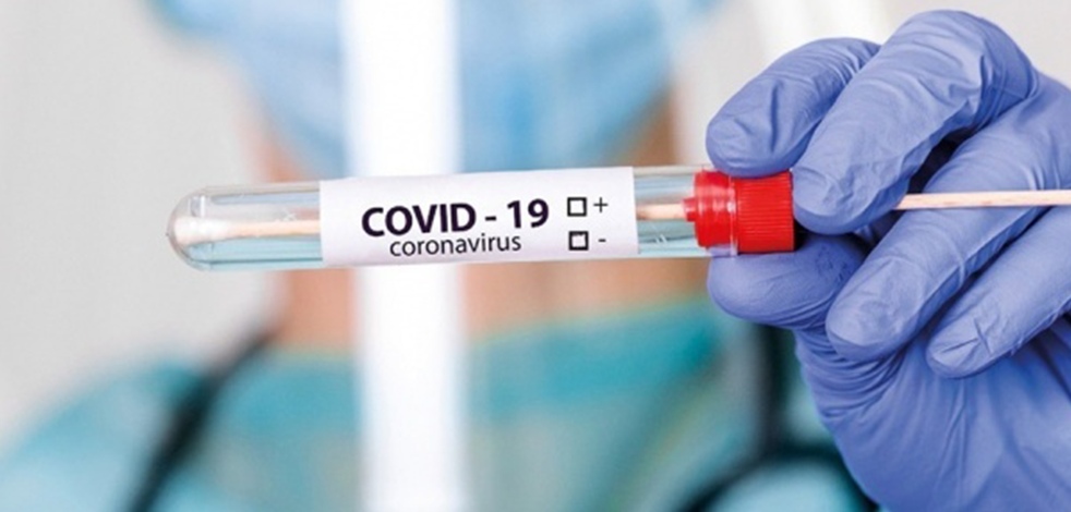 KKTC'de son 24 saatte 28 yeni vaka