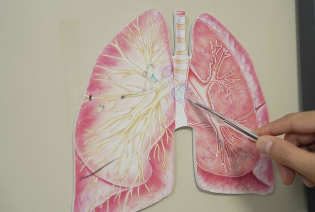 KOAH nefesinizi sessizce kesiyor