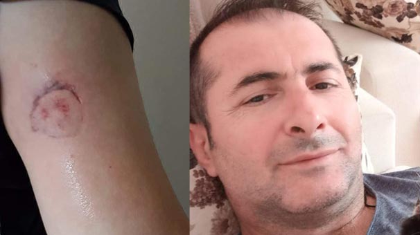 Kocaeli'de acile sarhoş girdi! Sağlık memurunun kolunu ağzından zor aldılar...